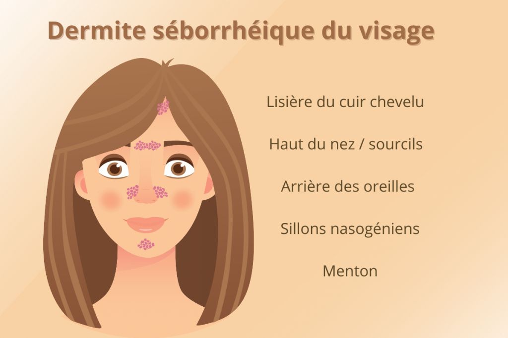 Dermite séborrhéique du visage : adoptez la bonne routine