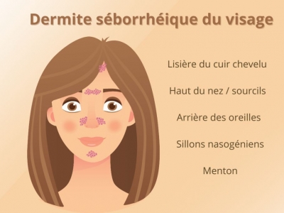 dermite séborrhéique photo visage